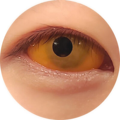 Sweety Orange Sclera Contacts (1 Lens/Pack)